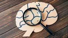 Jak poprawić pamięć: proste sposoby, dzięki którym już niczego nie zapomnisz